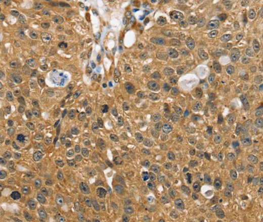SORT1 Polyclonal Antibody - image 1