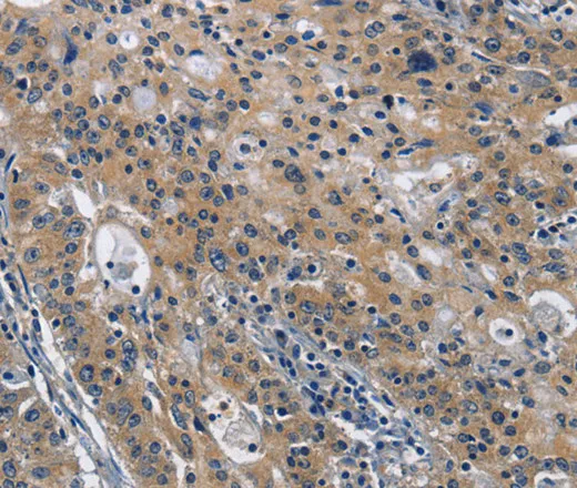 CD160 Polyclonal Antibody - image 1