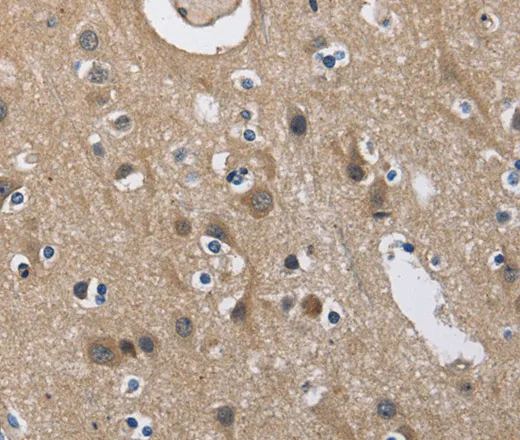 CD160 Polyclonal Antibody - image 1