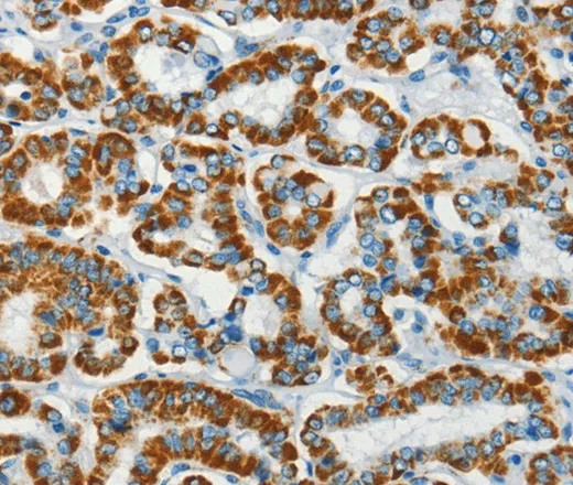 BCAT2 Polyclonal Antibody - image 1