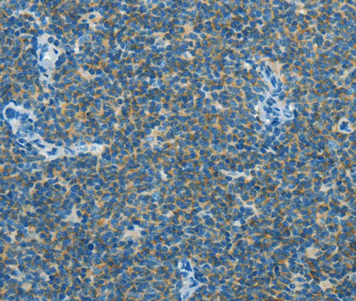 CAV3 Polyclonal Antibody - image 1