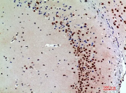 SNCA Polyclonal Antibody - image 1