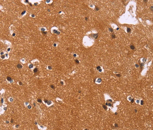 CBX3 Polyclonal Antibody - image 1