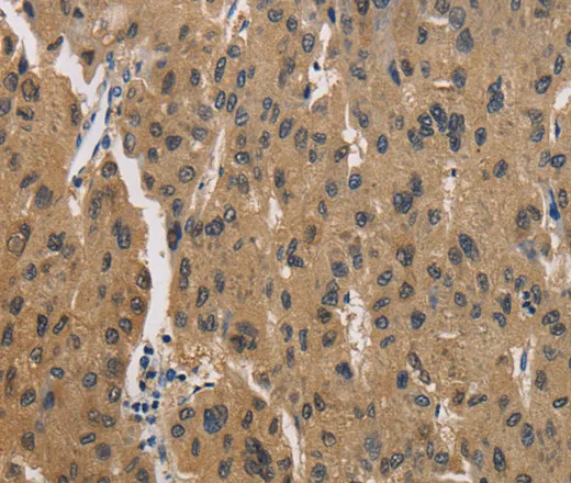 CKMT2 Polyclonal Antibody - image 1