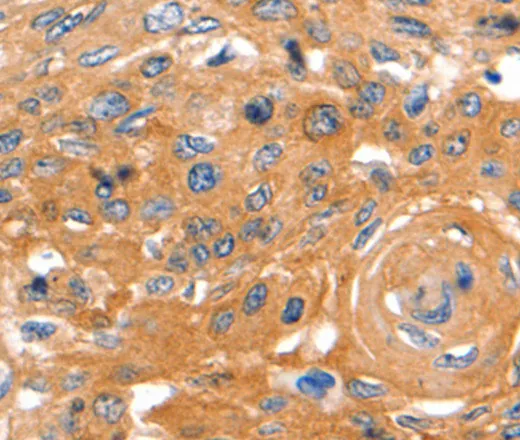 CAP2 Polyclonal Antibody - image 1