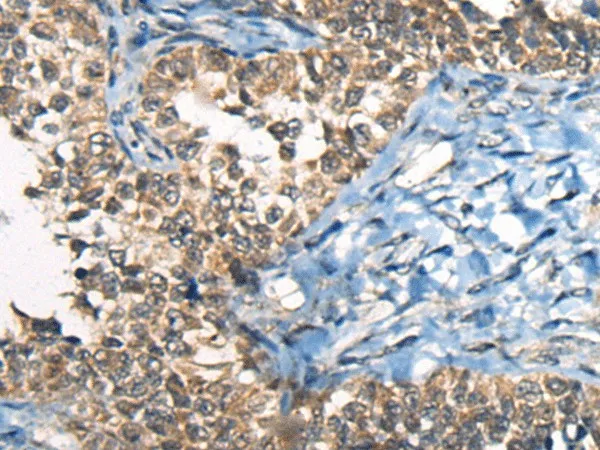 CDKL4 Polyclonal Antibody - image 1
