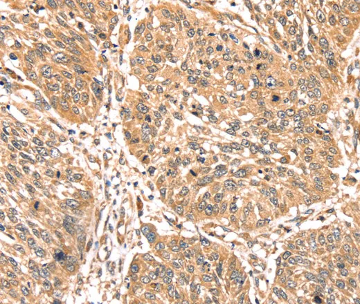 PDLIM4 Polyclonal Antibody - image 1