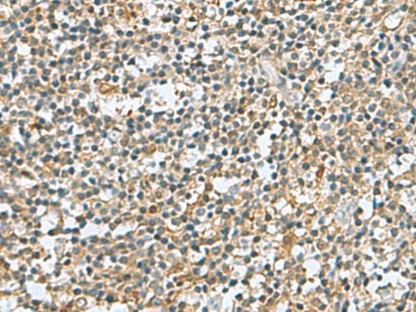 DNPH1 Polyclonal Antibody - image 1