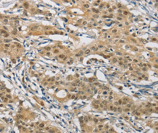 NAPSA Polyclonal Antibody - image 1