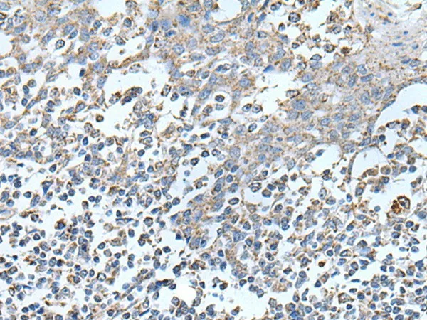 IRF5 Polyclonal Antibody - image 1