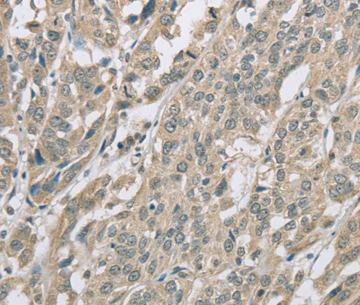 EDA2R Polyclonal Antibody - image 1
