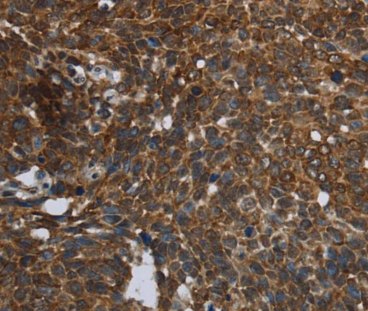 FASTKD2 Polyclonal Antibody - image 1