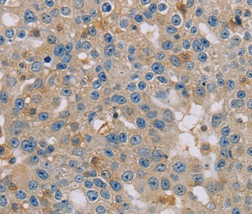 CLIC1 Polyclonal Antibody - image 1