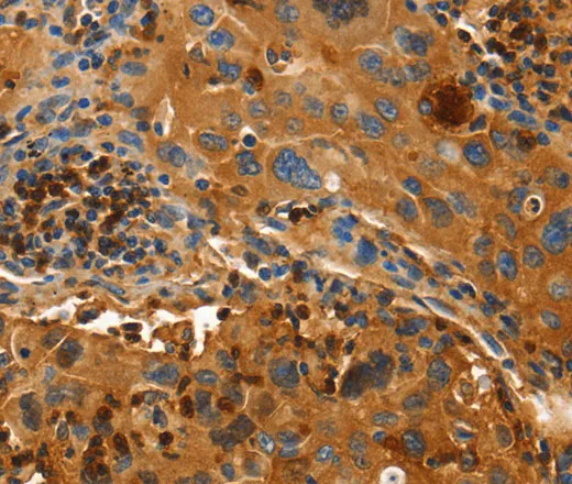 ORM2 Polyclonal Antibody - image 1