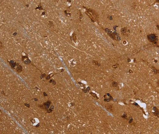 FLNA Polyclonal Antibody - image 1
