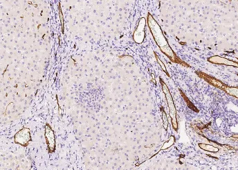 CD34 Monoclonal Antibody - image 1