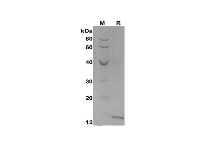 Recombinant humaan CXCL10-eiwit (His Tag)