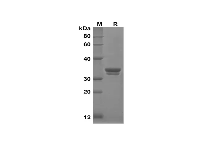 Recombinant humaan GDF15-eiwit (Sumo-tag)