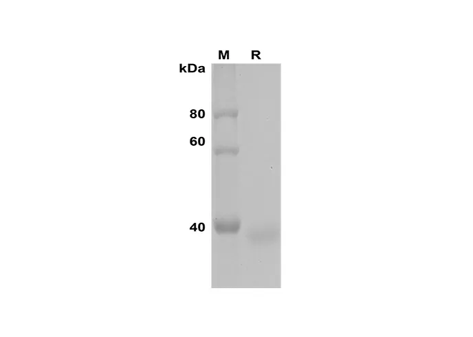 Recombinant humaan MYL1-eiwit (Sumo-tag)