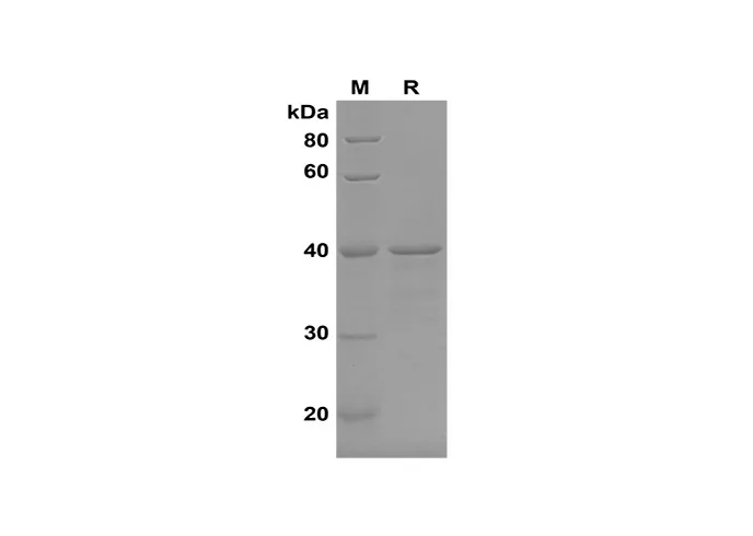 Recombinant humaan DAO-eiwit (zijn label)