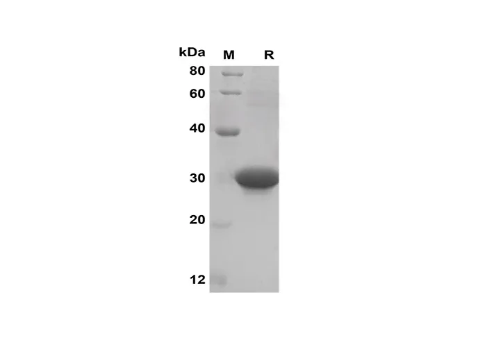 Recombinant Mouse CXCL10 Protein (Sumo Tag) - image 1