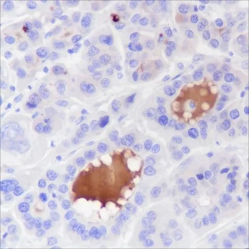 Recombinant Complement C4-B Monoclonal Antibody - image 1