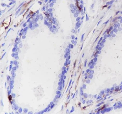 Recombinant Calponine 1 Monoklonale Antilichaam