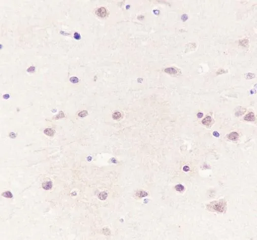Recombinatie CSNK2A1 monoklonaal antilichaam