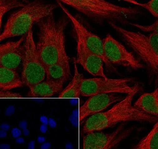 Recombinant CHD3 monoklonaal antilichaam