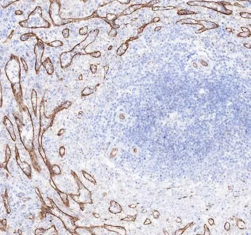 Recombinatie ICAM-2 monoklonaal antilichaam