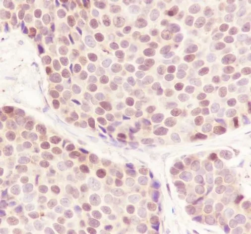 Recombinant CBX4 monoklonaal antilichaam