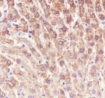 Recombinant ALDH7A1 Monoklonale Antilichaam