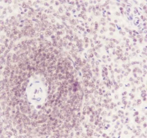 Recombinatie ATF1 monoklonaal antilichaam