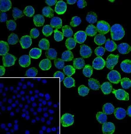 Recombinant IKB beta Monoklonale Antilichaam