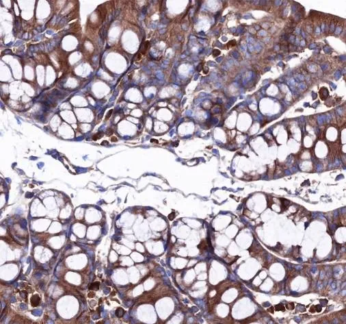 Recombinant Rock2 + Rock1 monoklonaal antilichaam