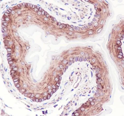Recombinant IL-1RA Monoklonale Antilichaam