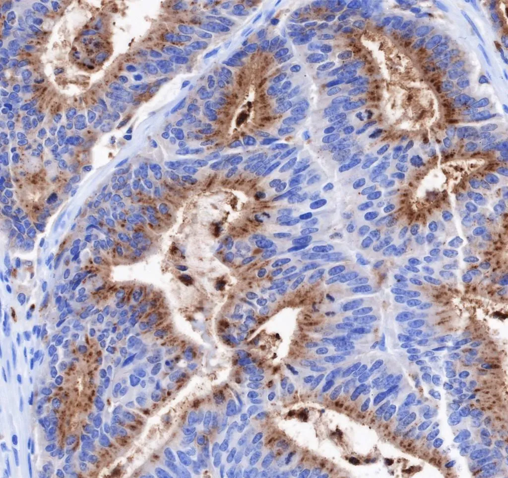 Recombinatie CEACAM6 monoklonaal antilichaam