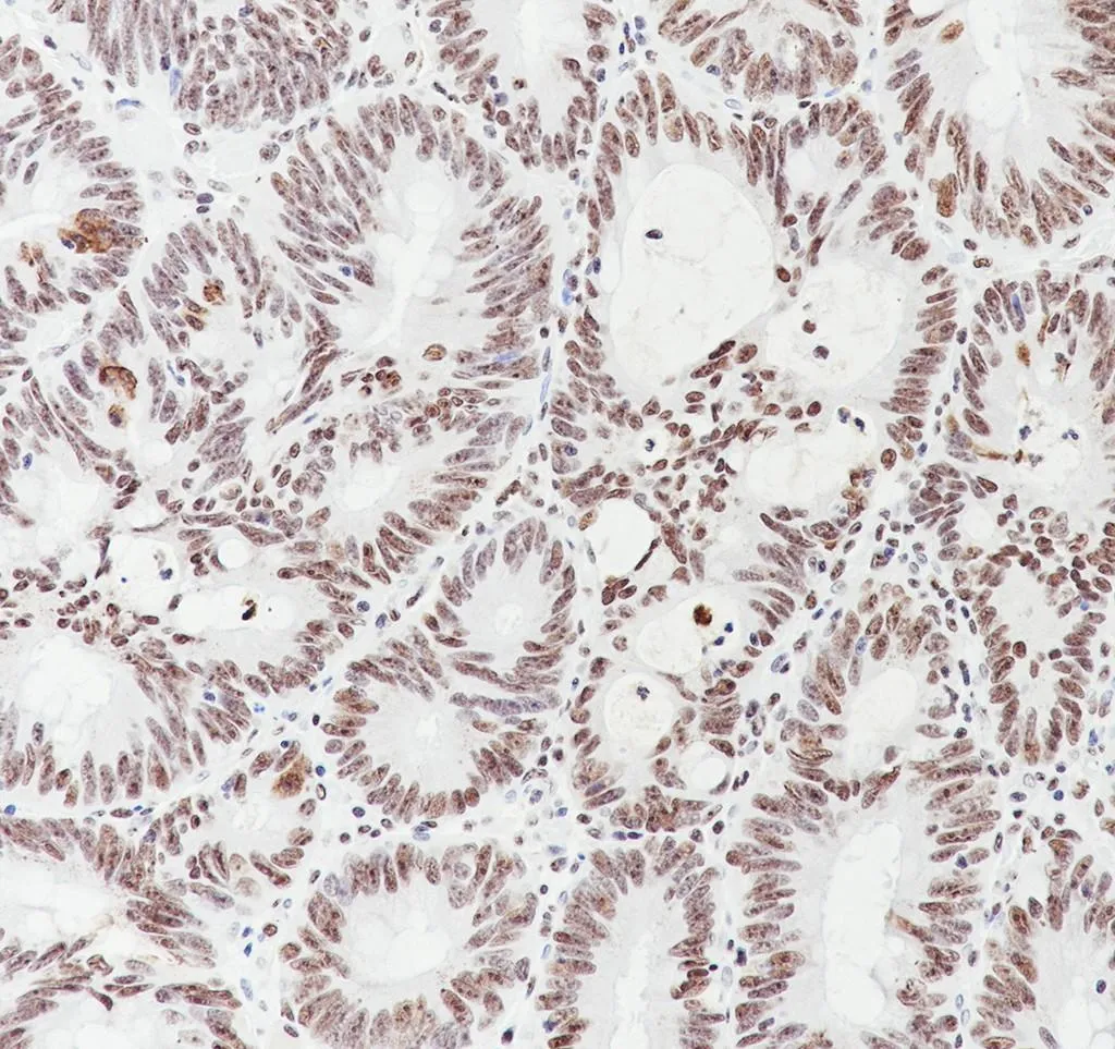 Recombinant MORF4L2 Monoklonale Antilichaam