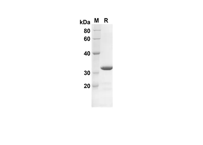 Recombinant Mouse Ccl7 Protein(Trx Tag) - image 1