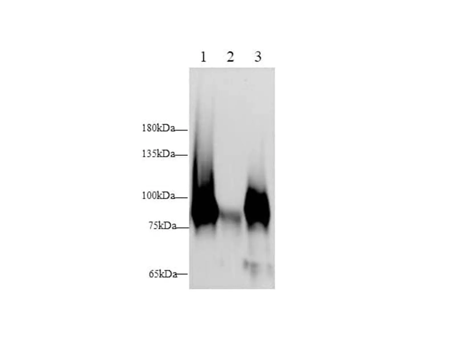 VCAM-1/CD106 Polyclonal Antibody (Capture/Detector) - image 1