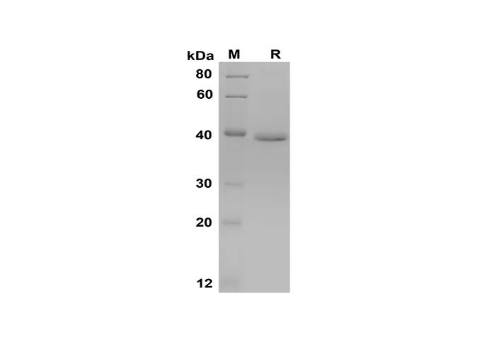 Recombinant Mouse PⅢNP Protein(Trx Tag) - image 1
