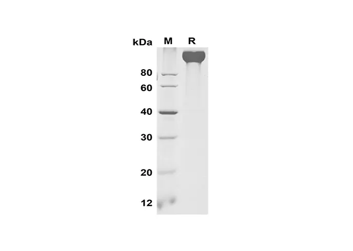 Recombinant Mouse VEGF R2/Flk-1 Protein(Fc Tag) - image 1