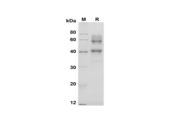 Recombinant Mouse CD25/IL-2 Rα Protein(Fc Tag) - image 1