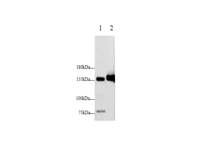 E-Cadherin Polyclonal Antibody - image 1