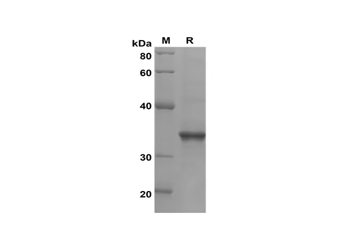 Recombinant Mouse CCL25/TECK Protein(Trx Tag) - image 1
