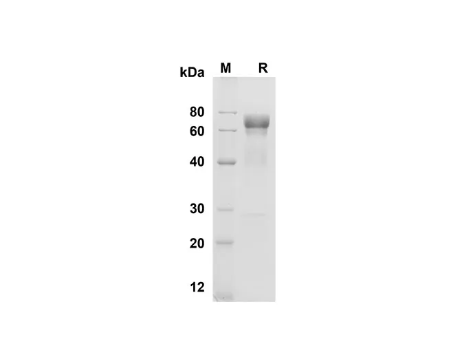 Recombinant Mouse Cathepsin B Protein(Fc Tag) - image 1