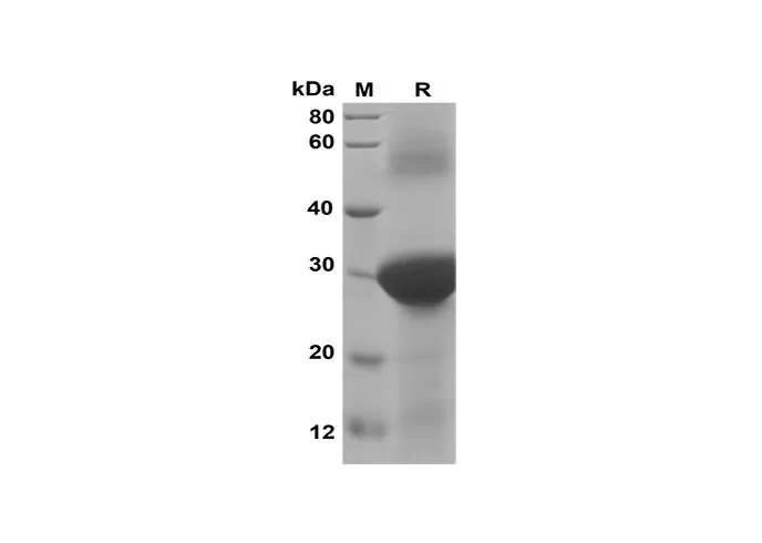 Recombinant Human CXCL7/NAP-2 Protein(Trx Tag) - image 1