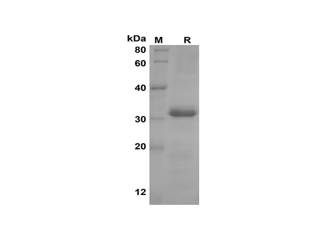 Recombinant Human CXCL4/CXCL4/PF4 Protein(Trx Tag) - image 1