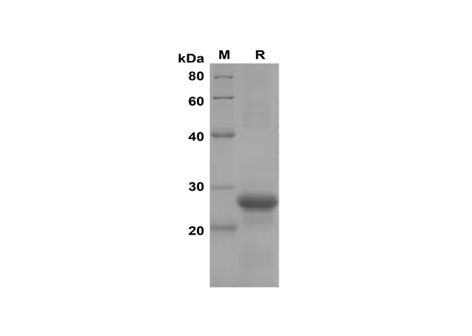 Recombinant Mouse CXCL2/MIP-2 Protein(Sumo Tag) - image 1