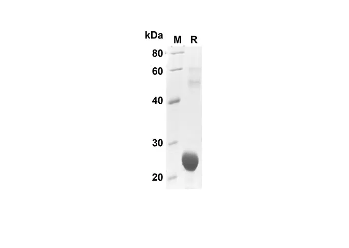 Recombinant Human CXCL7/NAP-2 Protein(Sumo Tag) - image 1